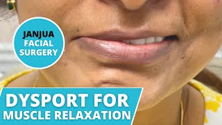 DYSPORT FOR MUSCLE RELAXATION ON BELL'S PALSY PATIENT - DR. TANVEER JANJUA - NEW JERSEY