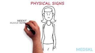 Psychiatry – Anorexia Nervosa: By Megen Vo M.D. & Sara Buckelew M.D. YouTube Videos