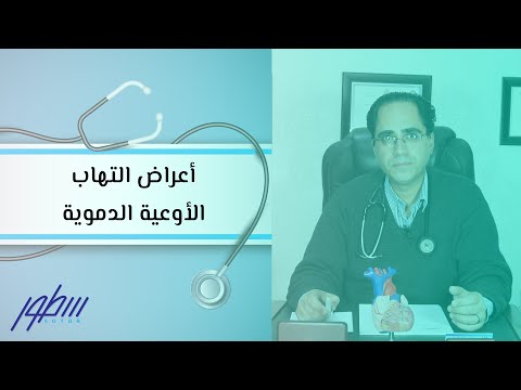 فيديو: كيفية تشخيص التهاب الأوعية الدموية (بالصور)