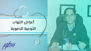 أعراض التهاب الأوعية الدموية