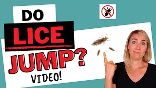 Do Lice Jump? Video!