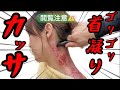 【とんでもない肩凝り‼️】驚愕の色💦一般患者さんが登場!施術したらとんでも無いことに💦前編