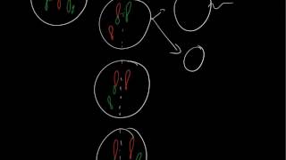 Robertsonian translocation: 21q14q