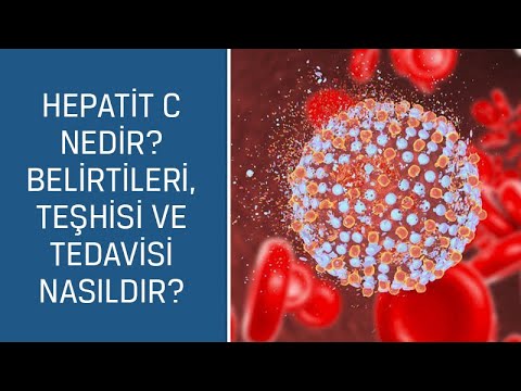 Doç. Dr. Salih Boğa cevaplıyor; Hepatit C nedir? Belirtileri, teşhisi ve tedavisi nasıldır?