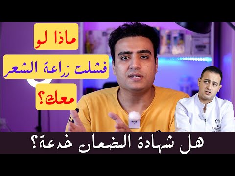 هل ممكن زراعة الشعر تفشل برنامج البسيط 