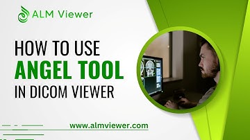 How to Use Angel Tool in Dicom Viewer | By Alm Viewer
