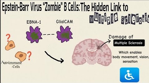 EBV infected"Zombie"B Cells:The Hidden Link to Multiple Sclerosis|Breakthrough Junior Challenge 2025