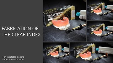 Fabricating the clear index for the injection molding restorations with flowable composite