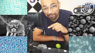 Viendo lo que hay dentro de mi cuerpo, probando 2 microscopios electrónicos ¡WOW! |NQUEH