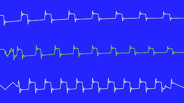COMMODORE C64 SID - SYS64738 DAYS - LINUS - 2018 - X18 (Oscilloscope View)