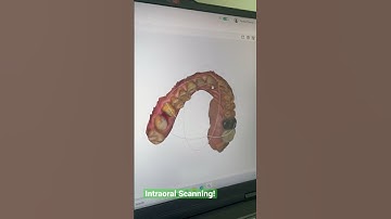 Revolutionize dental care with Dental Excel