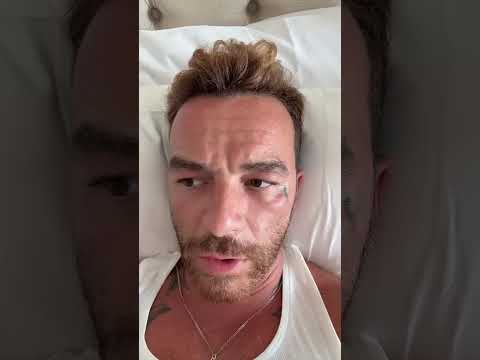 Video Salmo: «Ho il cancro alla pelle, è colpa delle creme solari». Scoppia la polemica