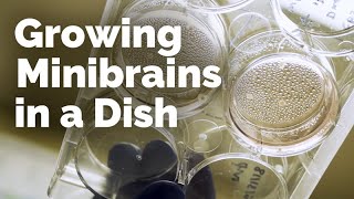 Growing Minibrains In a Dish