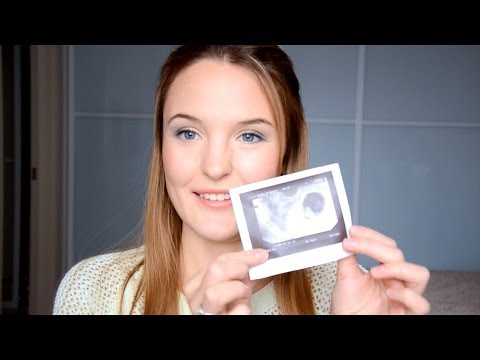 Моя беременность 10 неделя.