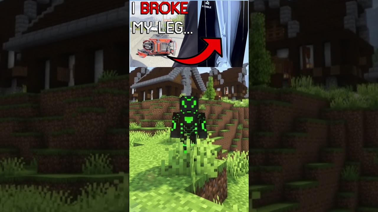 I broke my leg... (Storytime up now!) 