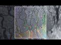 Alt J Breezeblocks Slowed Reverb