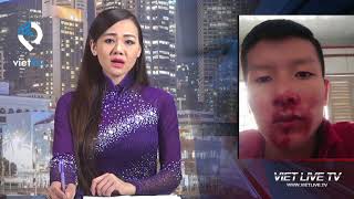 Download Công An Xã T N Mỹ, Huyện Thanh Bình, Tỉnh Đồng Tháp Lấy Lời Khai N Video MP3 Công An Xã T N Mỹ, Huyện Thanh Bình, Tỉnh Đồng Tháp Lấy Lời Khai N
