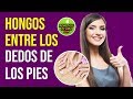 ✅😱Hongos Entre Los Dedos De Los Pies