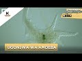 DALILI NA TIBA UGONJWA WA AMOEBA DALILI NA TIBA UGONJWA WA AMOEBA