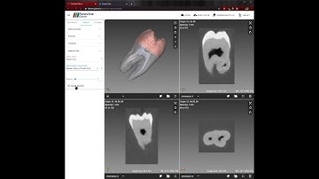 ParaView Glance and ITK.js