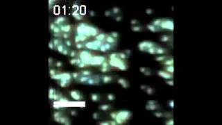 Spectral Fingerprinting of Individual Cells Visualized by Cavity-Reflection-Enhanced Light...