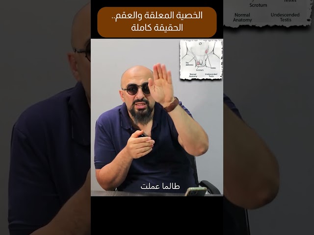 معرض الصور 2 الخصية المعلقة والعقم  الحقيقة كاملة