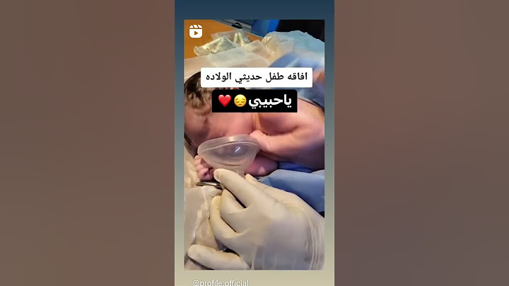 #افاقه طفل حديث الولاده 🥺