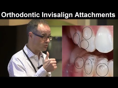 Role of Invisalign Attachments/Clear Aligner Systems in Orthodontic Treatment by Dr Mike Mew