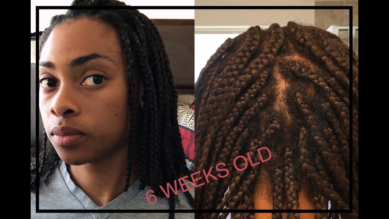 How I Took Down My Braids While Preventing Breakage | Individuals on
