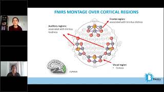 Objective Measurement of Tinnitus using functional Near Infrared Spectroscopy fNIRS