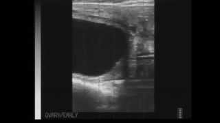 Ultrasound Quiz  Pregnant or Open? (questions)