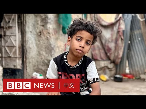 也門內戰近十年 過萬名兒童傷亡 － BBC News 中文