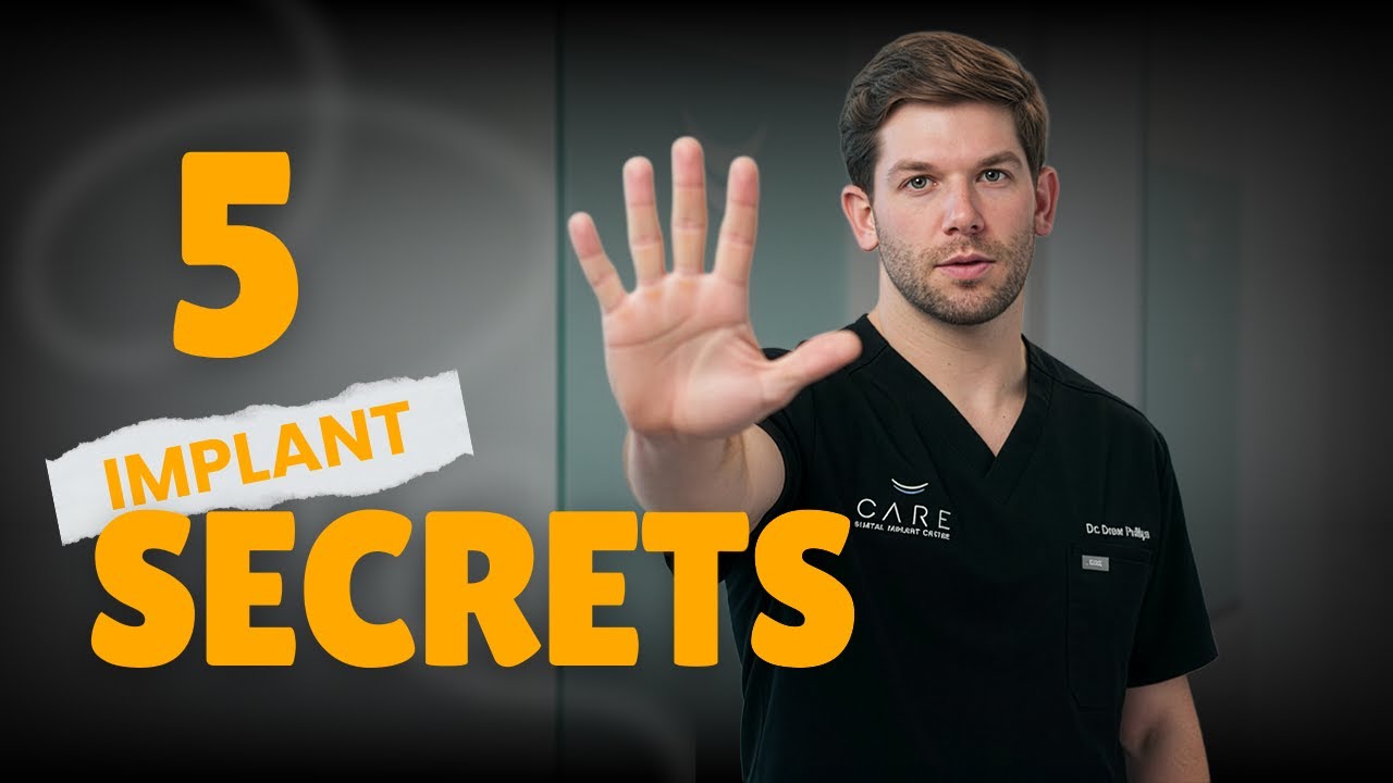 5 Dental Implant Secrets Most Offices Don’t Tell You