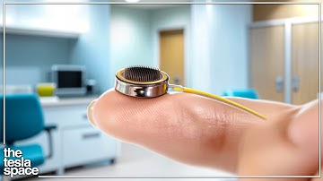 Nieuw hersenimplantaat begint met menselijke proeven