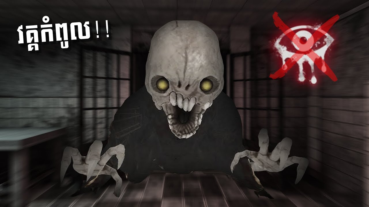 បែកពេញពេទ្យ 🤯 | Eyes