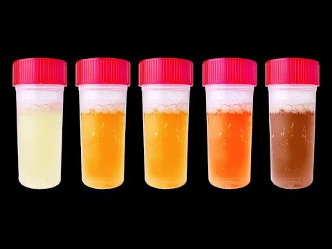 Tu orina puede revelar cosas sobre tu salud: ¡No ignores su color!