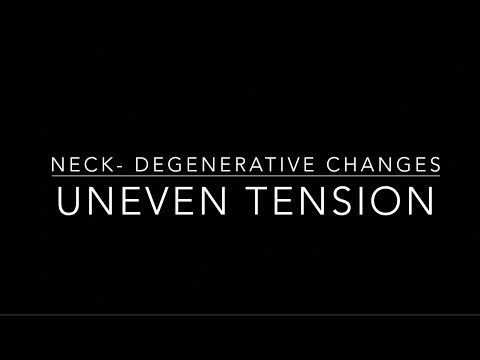 Degenerative Changes in the Neck