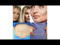 عمليات التجميل بين مؤيد و معارض الايجابيات والسلبيات