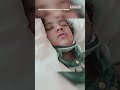 ‘A true walking miracle’