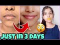 How I get rid of Pigmented lips 👄  REAL LIP CARE ROUTINE changes my lip colour