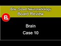 Neuroradiology Board Review - Brain Case 10