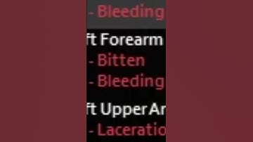 When You Get Bitten In Project Zomboid...