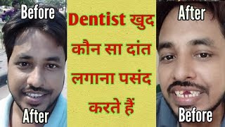 Fix teeth bridge cost | फिक्स दांत कैसे लगातें हैं | Dental bridge in Hindi