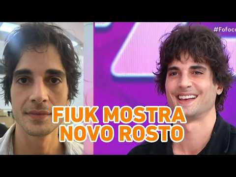 Fiuk mostra como ficou novo rosto após fazer harmonização facial; Veja imagens do resultado!
