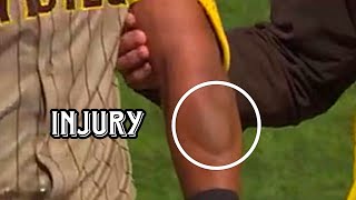 MLB / WORST INJURIES 2025 COMPILATION