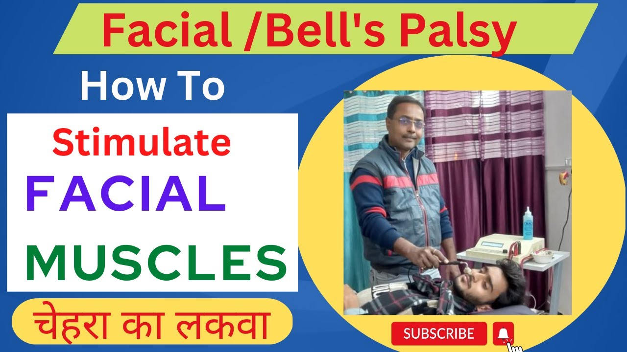 Physiotherapy Management On Bell's Palsy - PORTAL MyHEALTH