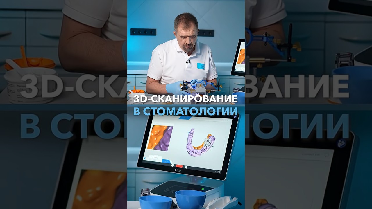 3D СКАНИРОВАНИЕ В СТОМАТОЛОГИИ 