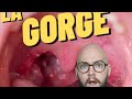 QUE VOIT VOTRE MГ DECIN DANS VOTRE GORGE рџ QUE VOIT VOTRE MГ DECIN DANS VOTRE GORGE рџ