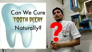 Stages of Tooth Decay & Pain Explained - Dr Pathak | दाँतों की सड़न का कारण ? Layers of teeth Inside
