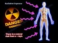 Radiation Exposure ,Radiation safety- Everything You Need To Know - Dr. Nabil Ebraheim